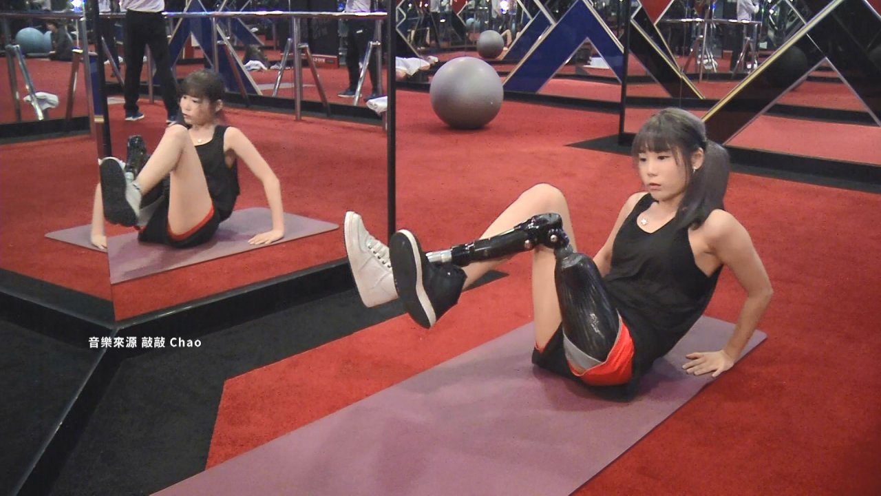 Mất chân do tai nạn giao thông, cô gái trẻ dùng vũ đạo để đương đầu với số mệnh