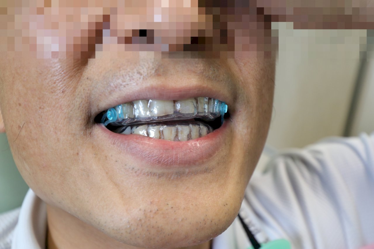 Càng lớn tuổi ngáy càng to coi chừng có nguy cơ bị đột tử
